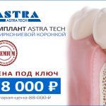 Акция имплант Астра Тек с циркониевой коронкой