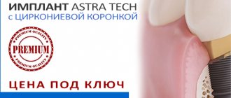 Акция имплант Астра Тек с циркониевой коронкой