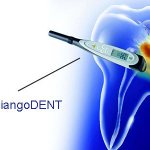 DiangoDENT device