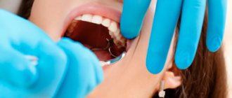 Болит десна после удаления зуба - Стоматология «Линия Улыбки»