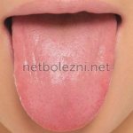 What does the color of the tongue mean?