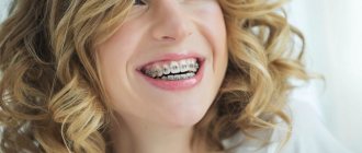 Girl with braces on her teeth