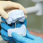 Stages of dental prosthetics and how long all procedures take