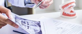 Photo at a dentist&#39;s appointment, who determines the diagnosis based on a photo of the jaw