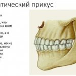 Характеристика ортогнатического прикуса