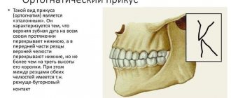 Характеристика ортогнатического прикуса