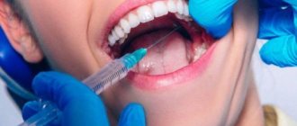 Infiltration anesthesia for dental treatment