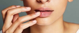 Как лечить обветренные губы в домашних условиях. Мази, народные средства, домашние рецепты