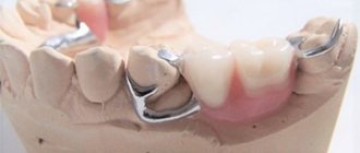 how to remove a clasp prosthesis photo