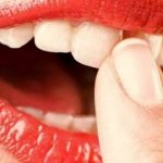 Как спасти зубы от пародонтоза уже шатаются зубы