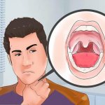 how to remove bad smell from throat