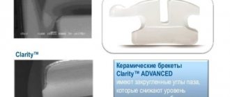 Какие технологии применяются при производстве брекетов Clarity