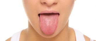 What color is the tongue for diseases? Causes of white, yellow, green, dark, brown plaque 