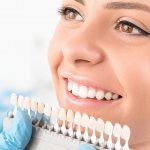 Классификация методов отбеливания зубов