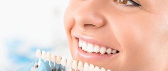Классификация методов отбеливания зубов
