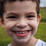 Boy with rare teeth