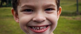 Boy with rare teeth