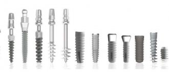 The photo shows various models of implants