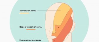 trigeminal neuralgia