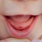 Is it normal for a child to have no teeth at 10 months?