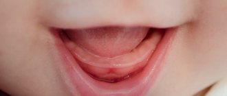 Нормально ли, если у ребенка в 10 месяцев нет зубов