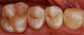 occlusal plane of teeth