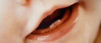Особенности лечения молочных зубов