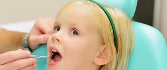 Features of filling materials in pediatric dentistry