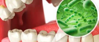 Pathogenic microorganisms contribute to aphthous stomatitis - Dentistry Line Smiles