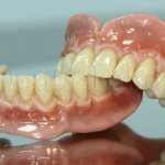 complete removable denture