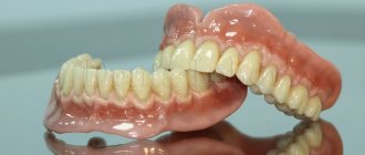 complete removable denture