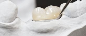 Causes of a gap between the crown and gum