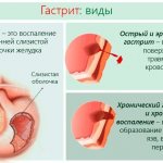 Привкус мыла во рту. Причины и лечение у женщин, мужчин