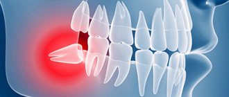 Tooth retention