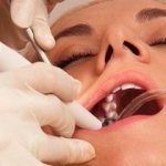 Sedation in dentistry