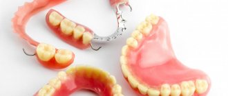 removable dentures