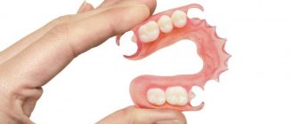 Silicone dental prosthesis advantages and disadvantages full removable