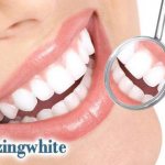система отбеливания Amazing White у стоматолога отзывы