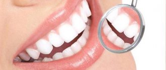 Amazing White whitening system at the dentist reviews