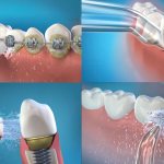 Modern dentistry offers new care technologies