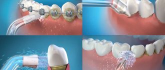 Современная стоматология предлагает новые технологии ухода
