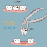 Tooth extraction for children under anesthesia in pictures