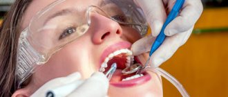 Удаление зубов ультразвуком - Стоматология «Линия Улыбки»