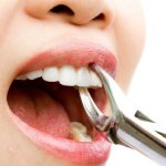 Удалить зуб могут по многим причинам