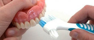 Care and cleaning of removable dentures (acrylic, Acri-Free, nylon, clasp)