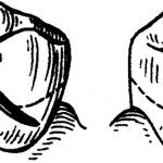 Types of clasps and their components