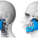 Types of operations to correct bite