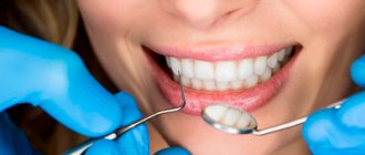 Intra-canal whitening - Smile Line Dentistry