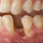 Restoration of dental-alveolar defects: a multidisciplinary approach