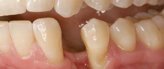 Restoration of dental-alveolar defects: a multidisciplinary approach